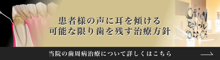 歯周病治療｜港区汐留の歯医者・歯科｜オリオン歯科 NBFコモディオ汐留クリニック東京